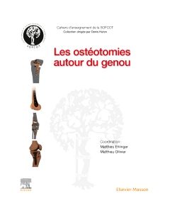 Les ostéotomies autour du genou