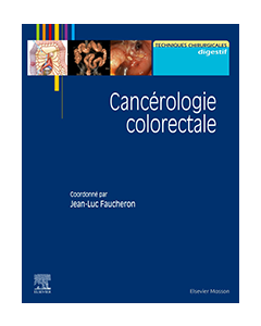 Cancérologie colorectale