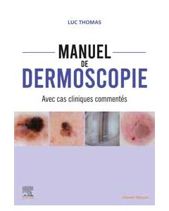 Manuel de dermoscopie