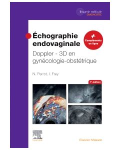 Échographie endovaginale Doppler - 3D