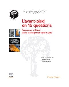 L'avant-pied en 15 questions