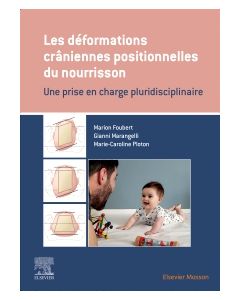 Les déformations crâniennes positionnelles du nourrisson