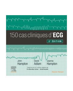 150 cas cliniques d'ECG