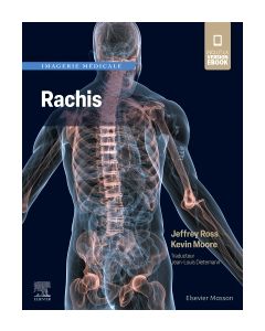 Imagerie médicale : Rachis