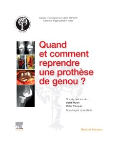 Quand et comment reprendre une proth&egrave;se de genou ?