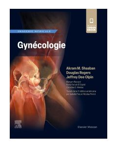 Imagerie médicale : Gynécologie