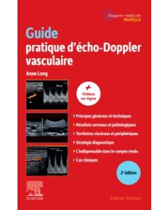 Guide pratique d'écho-Doppler vasculaire