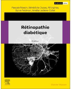 Rétinopathie diabétique
