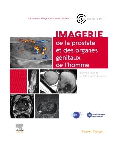 Imagerie de la prostate et des organes g&eacute;nitaux de l?homme