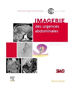 Imagerie des urgences abdominales