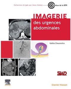 Imagerie des urgences abdominales