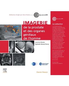 Imagerie du pelvis masculin