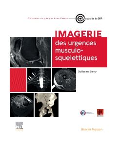 Imagerie des urgences musculosquelettiques