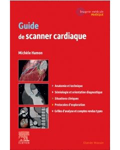 Guide de scanner cardiaque