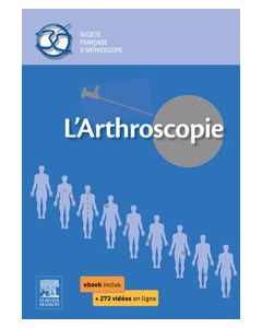 L'arthroscopie