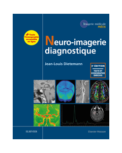 Neuro-imagerie diagnostique