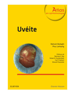 Uvéite