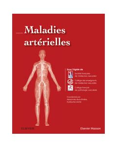 Maladies artérielles