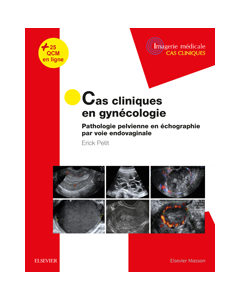 Cas cliniques en imagerie : gynécologie