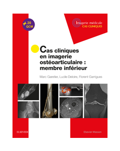 Cas cliniques en imagerie ostéoarticulaire : membre inférieur