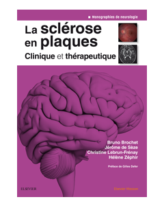 La sclérose en plaques - Clinique et thérapeutique