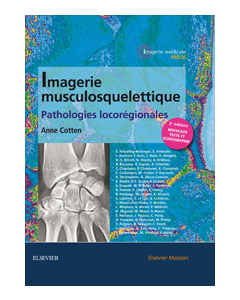 Imagerie musculosquelettique : pathologies locorégionales