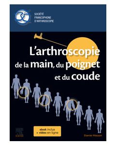 L'arthroscopie de la main, du poignet et du coude