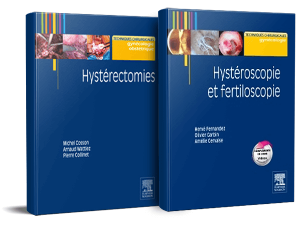 Hystérectomies/Hystéroscopie - Pack 2 Tomes