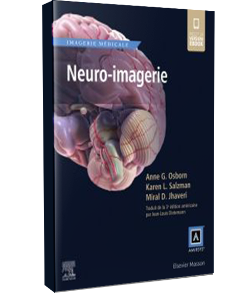 Neuro-imagerie