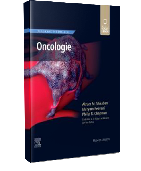 Oncologie 